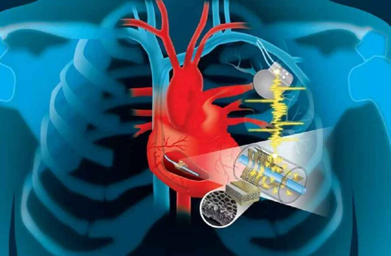 MIT Printable Metalfree Electrode